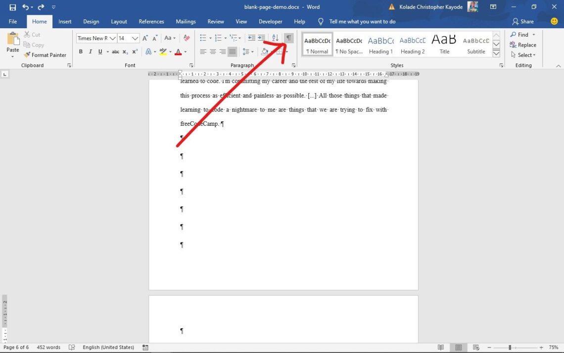 How to Delete a Page in Word (Including a Blank Page): Quick Guide