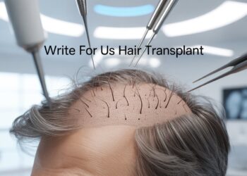 Write for Us Hair Transplant