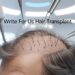 Write for Us Hair Transplant